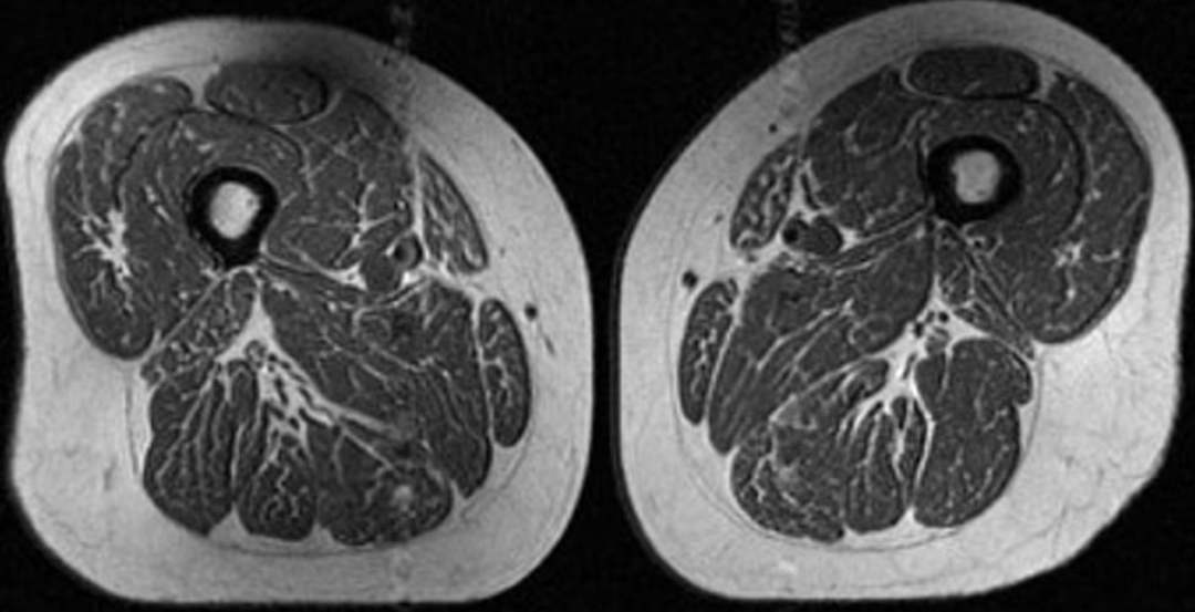Study links ultra‑processed foods to higher knee osteoarthritis risk. 🍔➡️🦵edition.cnn.com/2026/04/14/hea…

Choose whole foods for joint health.

#BoneHealth #CPOHealth #CanadianPharmacy