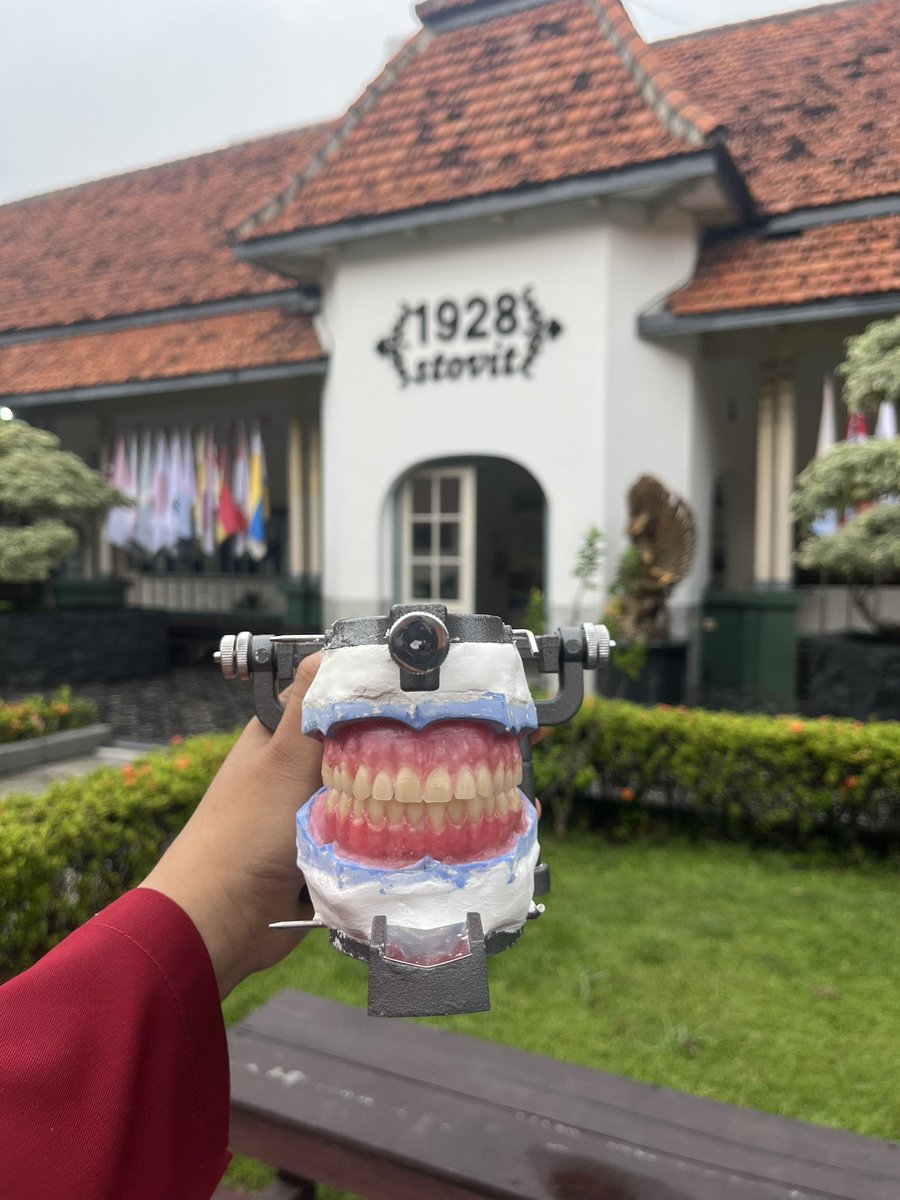 juyeonnns's tweet image. done for my very first full denture🩶
#stilllearning