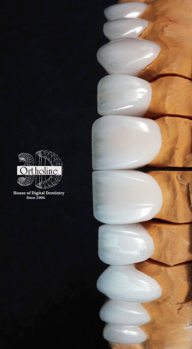 3dortholine's tweet photo. “Where art meets dentistry — veneers that look real.”

#3dortholine #newsmile #veneer #emax #dubai https://t.co/hy7hoiAsaR