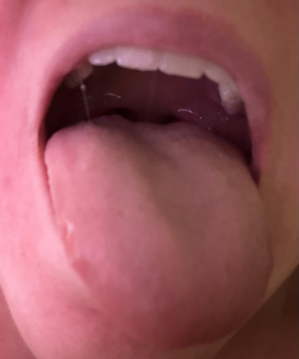 Royal Rabbit 🐰🩵 tweet media