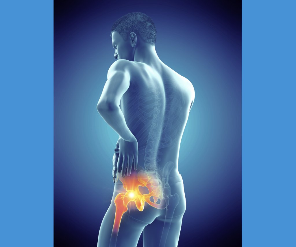 nashvilleorthos's tweet image. We have only truly understood #ischiofemoral #impingement as a diagnosis in recent years. In rare severe cases that fail conservative care, minimally invasive endoscopic surgery can open the ischiofemoral space &amp;amp; relieve symptoms. medilink.us/lk0a #hippain #sportsmedicine