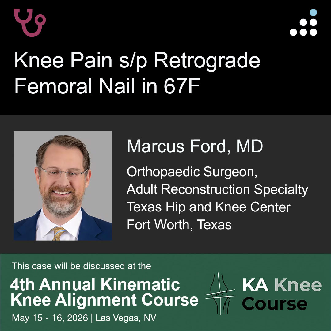 orthobullets's tweet image. Here is a new case by Dr. Marcus Ford and Texas Hip and Knee Center.

KNEE PAIN S/P RETROGRADE FEMORAL NAIL IN 67F

This case will be discussed at the 4th Annual Kinematic Knee Alignment Course in Las Vegas, NV, May 15-16, 2026.

How would you manage this #orthotwitter?

Vote on