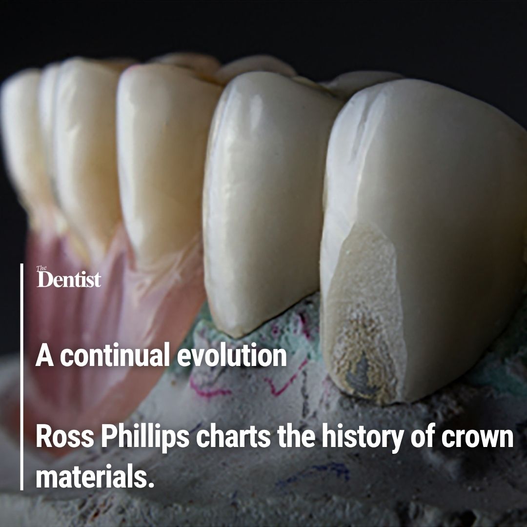 TheDentistMag's tweet image. A continual evolution

Ross Phillips charts the history of crown materials.

Read the full article here:
➡️  ow.ly/CxOh50YNA1e

#restorative #dentistry #dentalcrown #digital #dental