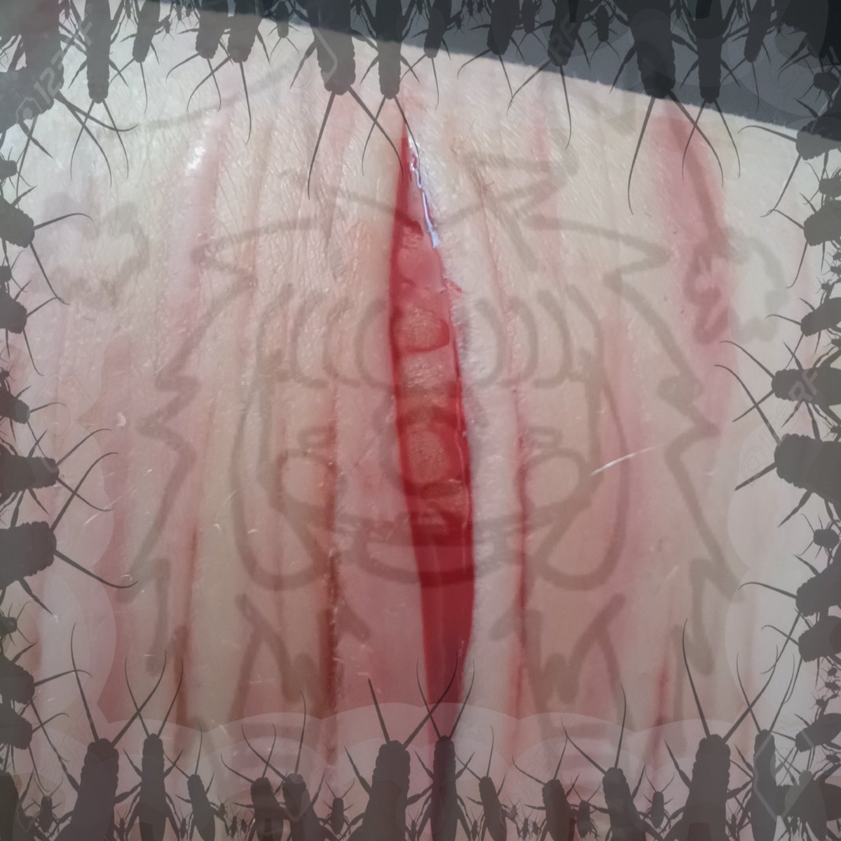 𓂃 ࣪˖ ִֶཐི༏ཋྀ󠀮| Bug | ཐིཋྀ ˖ ࣪⊹ tweet media