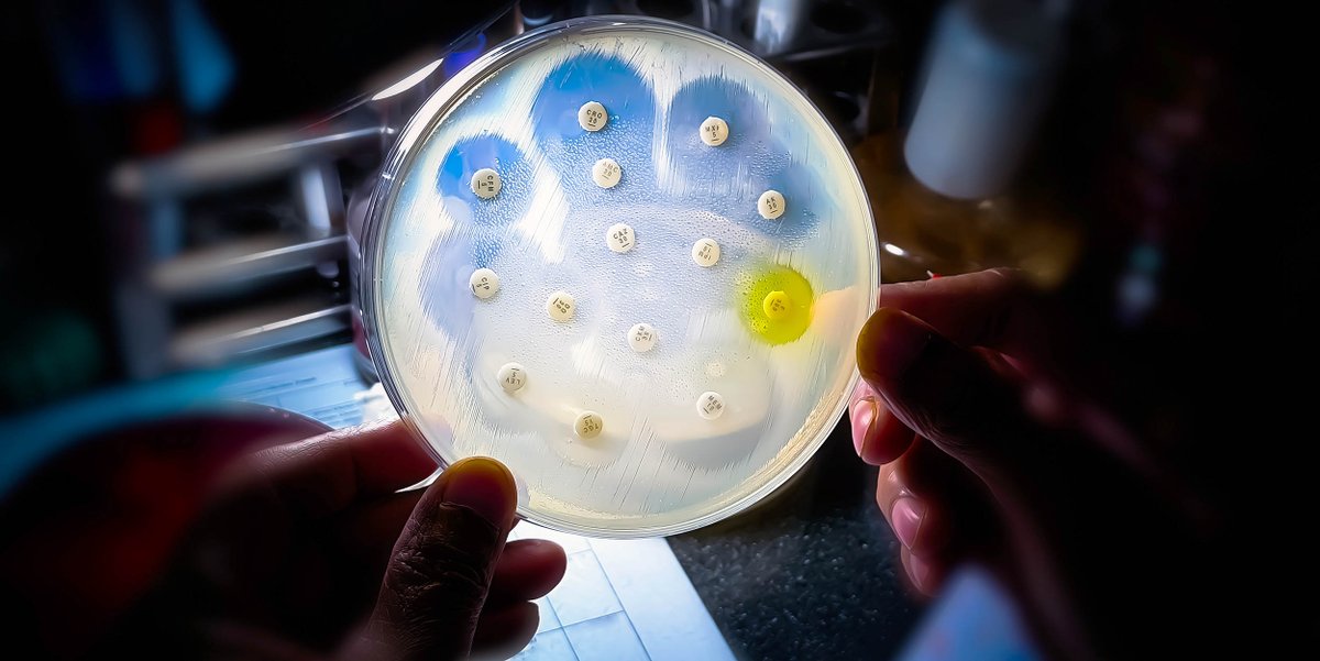 EarthDotCom's tweet image. WHO warning: High percentage of common infections worldwide are no longer responsive to antibiotics dlvr.it/TS8X6V #EarthDotCom #EarthSnap #Earth