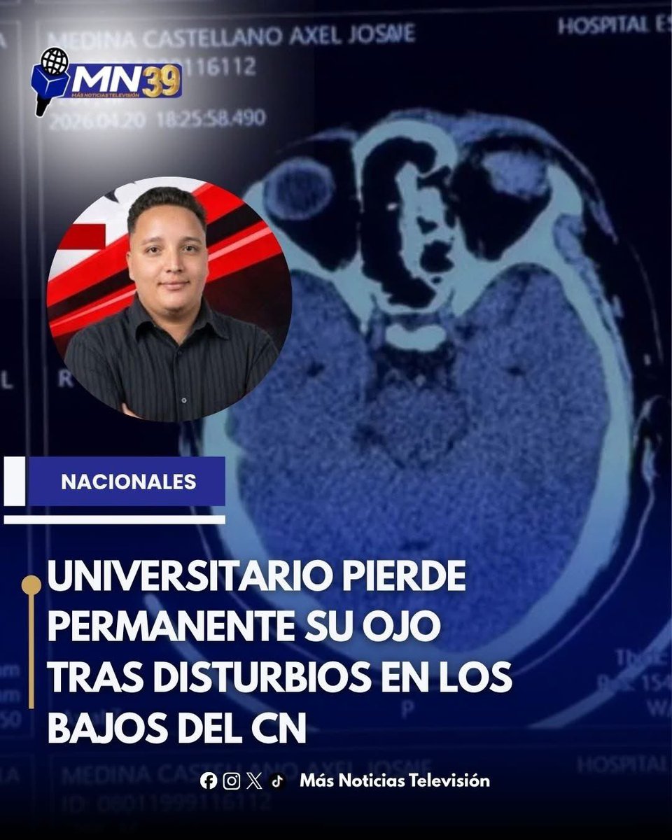Se condena la brutalidad y la represión extrema ejercida a los estudiantes que protestaban en las afueras del congreso nacional. Esa misma fuerza debe aplicarse en contra de las maras, de la barra violenta afuera del estadio, de los secuestradores, de los homicidas. 
Pero es más
