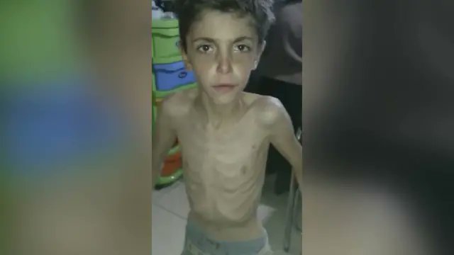 QalaatAlMudiq's tweet image. The kind of "freedom" provided by Hezbollah while starving children in Zabadani &amp;amp; Madaya (#Syria, 2016).