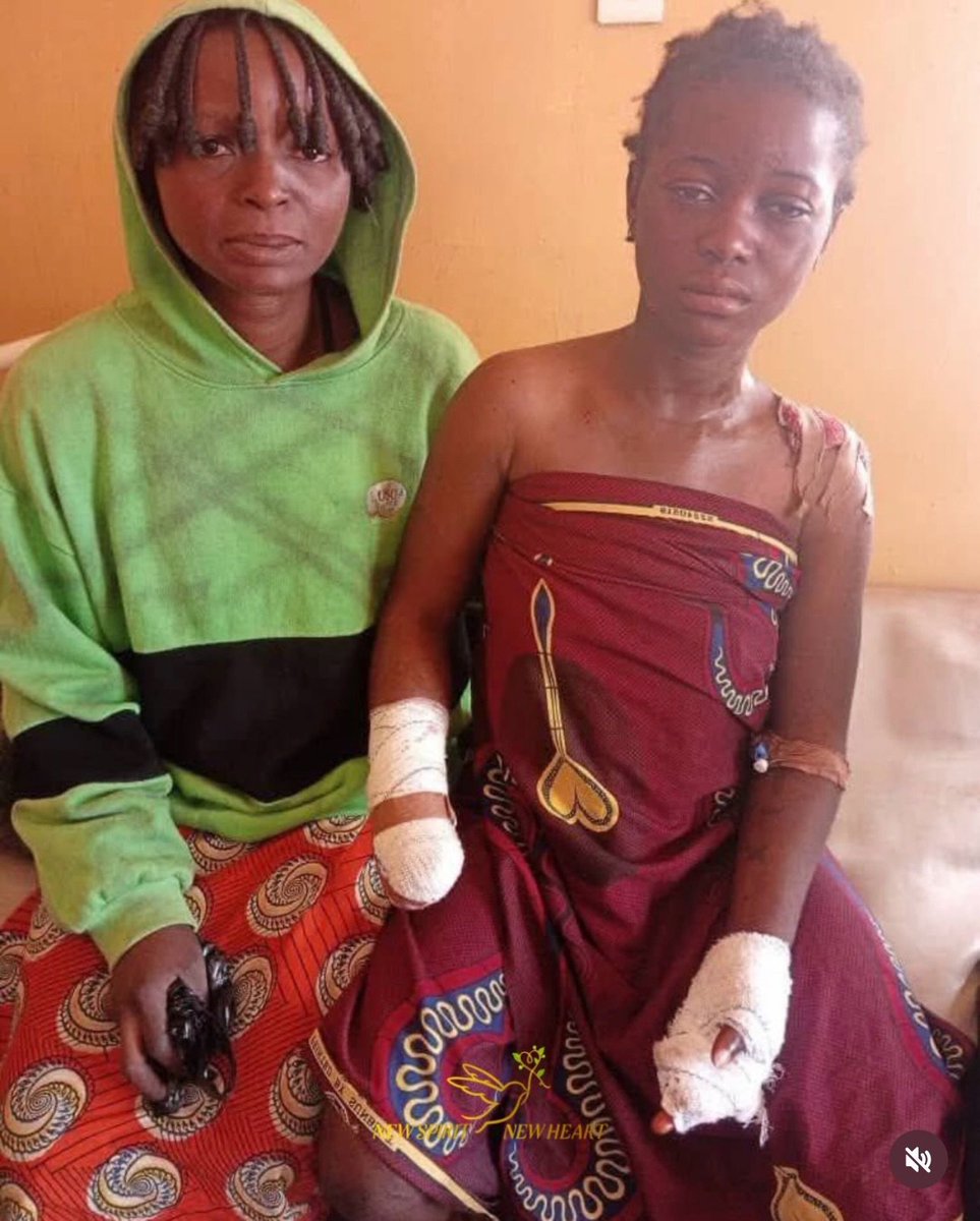 Islamistas fulani cortan la mano de una adolescente cristiana en Nigeria después de que su familia rechazara la propuesta de matrimonio.
Lo que están haciendo los islamistas con Nigeria ante la indiferencia del mundo es el más cruel de los genocidios, pero como los asesinos son