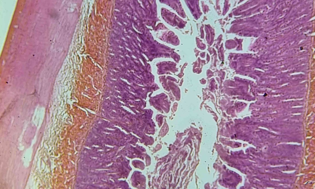 EarthDotCom's tweet image. Scientists uncover gut signals that may improve early cancer detection dlvr.it/TS8YkL #EarthDotCom #EarthSnap #Earth