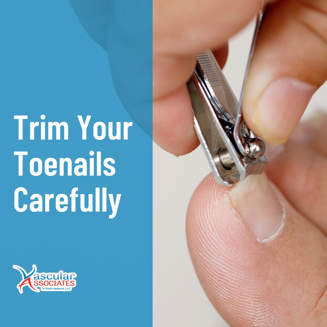 of_vascular's tweet photo. PAD can make cuts take longer to heal and raise your risk of infection. Trim your toenails straight across and file sharp edges to help prevent ingrown nails. If it’s hard to trim them safely, see a podiatrist.🦶

☎️ 251-410-8272

#Vascular #SouthAlabama https://t.co/uqHXnEcWsh