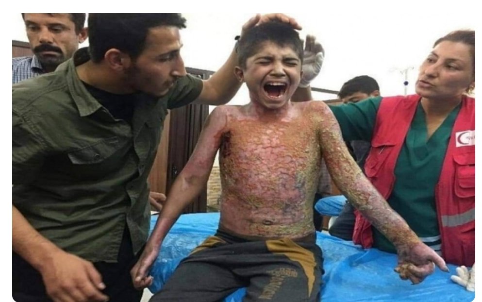 Ukrainene's tweet image. #Erdoğan has frequently declared his readiness to confront #Israel, labeling it a war criminal for its actions against #Hamas in #Gaza. Yet, he remains silent about the atrocities his own military has committed against the Kurdish people across #Turkey, #Iraq, and #Syria. A