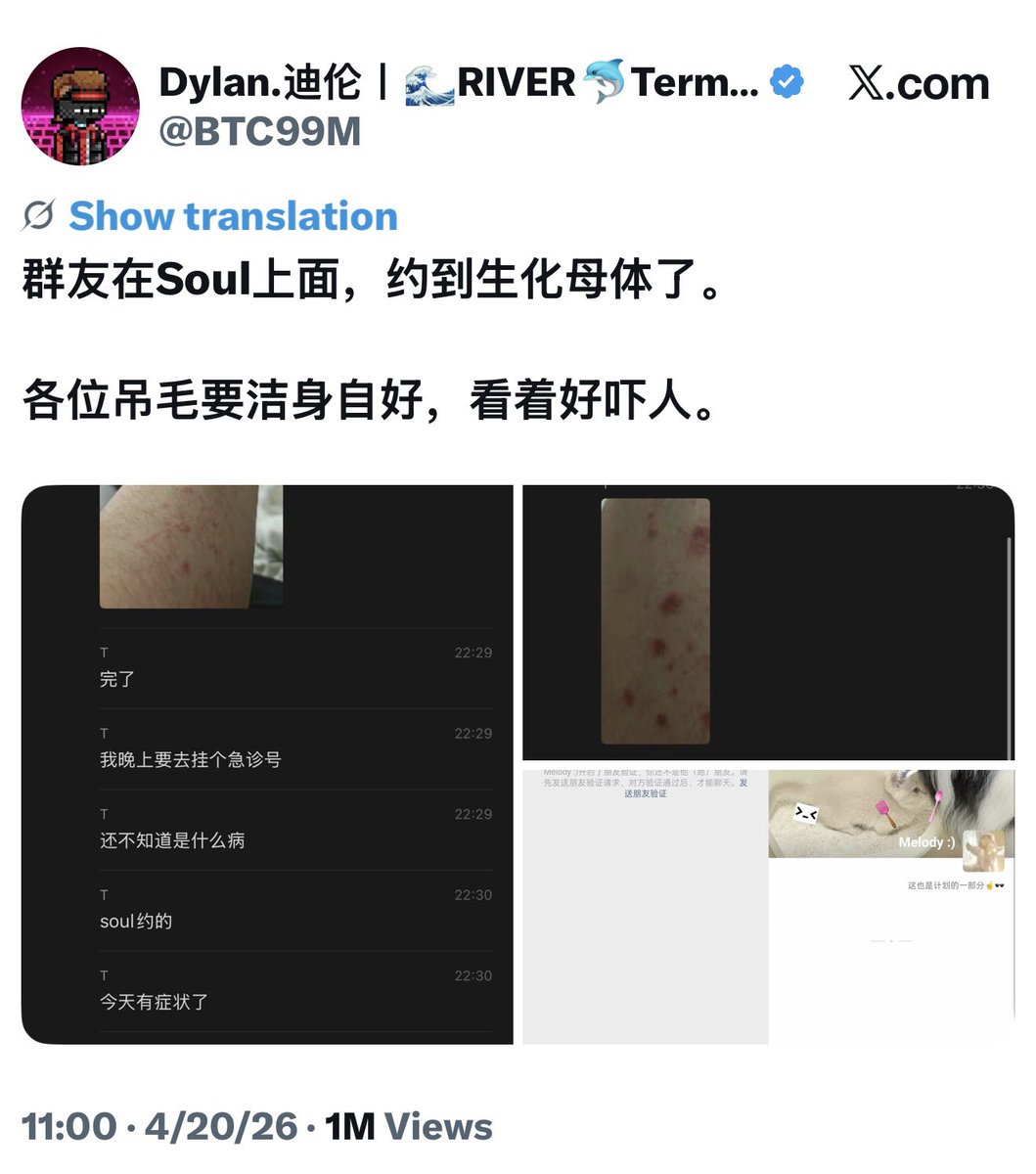 逃跑的韭菜🇺🇸 tweet media