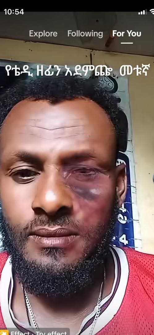 Freedom44225's tweet image. 🚨 When Music Becomes a Crime❓
People are reportedly being arrested and beaten for listening to Teddy’s music. Silencing art is silencing freedom.
@StateDept @UNHumanRights @hrw @amnesty @USEmbassyAddis
#Ethiopia #HumanRights #FreeSpeech #TeddyAfro #Justice