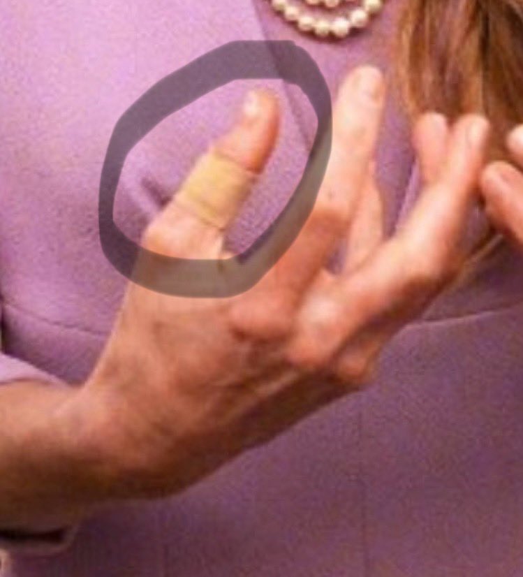 pushkin_thecat's tweet image. #KateMiddleton needs serious help! #eatingdisorders