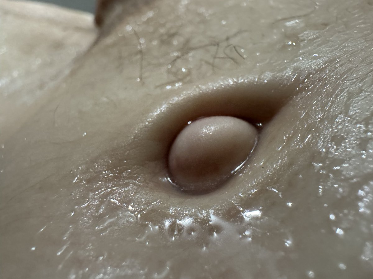 Jim Koopar tweet media