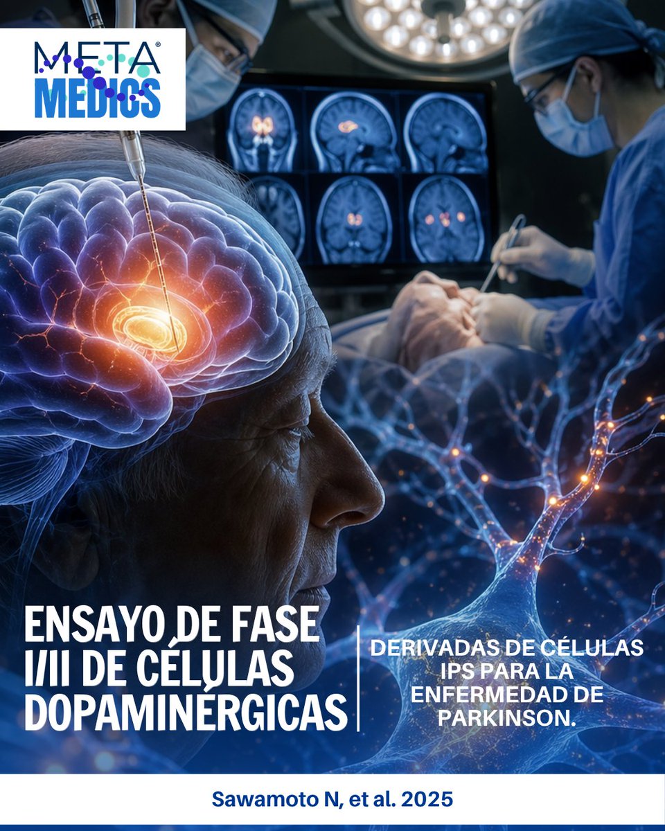 Metamedicsmx's tweet photo. Un ensayo clínico demuestra que neuronas derivadas de células iPS pueden sobrevivir, producir dopamina y mejorar síntomas en Parkinson sin eventos graves. Un avance clave en medicina regenerativa. Sawamoto N, et al. 2025. DOI: 10.1038/s41586-025-08700-0 https://t.co/4wxmuwRgm5