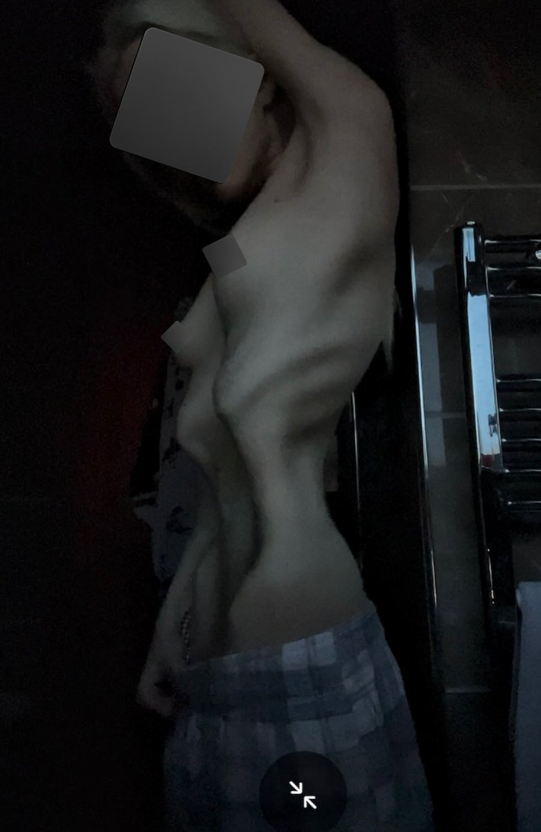 KURW4_D05C's tweet image. ﾉ⁠*⁠.⁠✧DAILY｡⁠*ﾟ⁠+
 #thinspo #thinsp0 #bonespo #bonesp0 #deathspo #deathsp0 #edtwt #anablur #edtw #twana #twed #edblur #edtblur #ed #anatw #proana