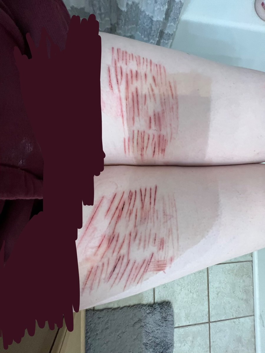 mosscoveredgrave shtwt tweet media