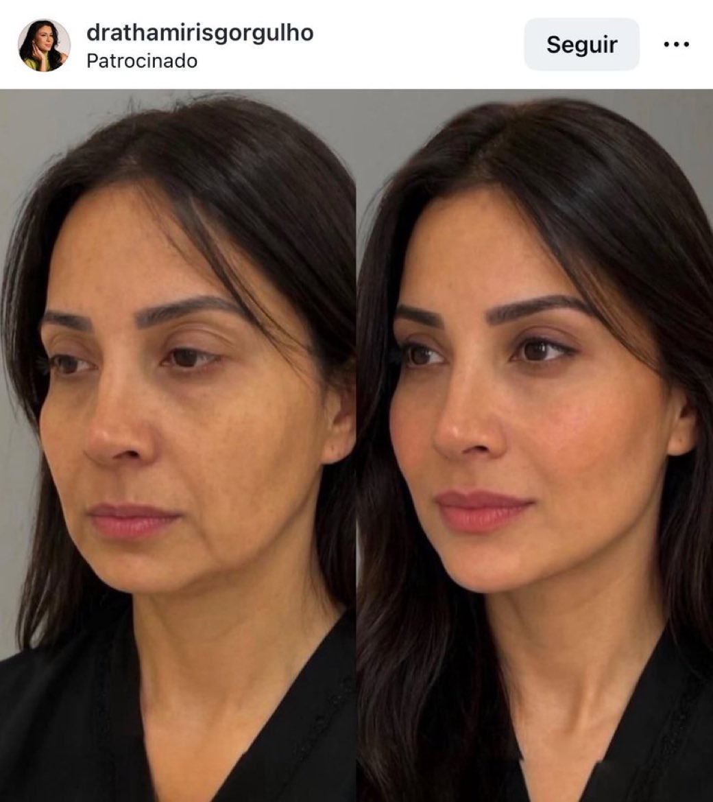 B’lee Herrera tweet media