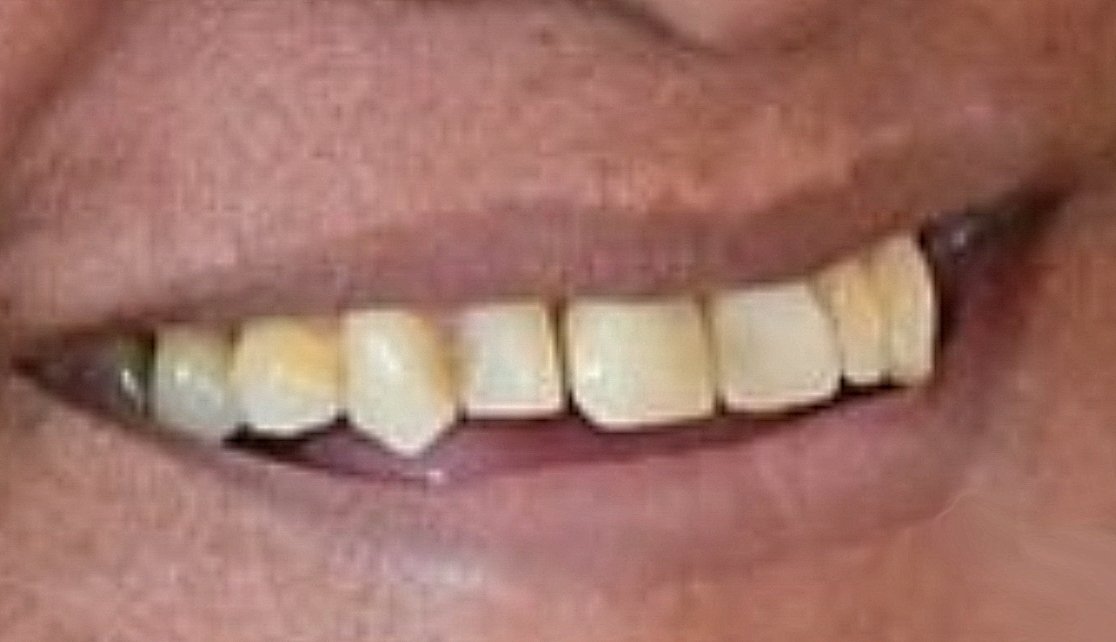 VickA. F. tweet media