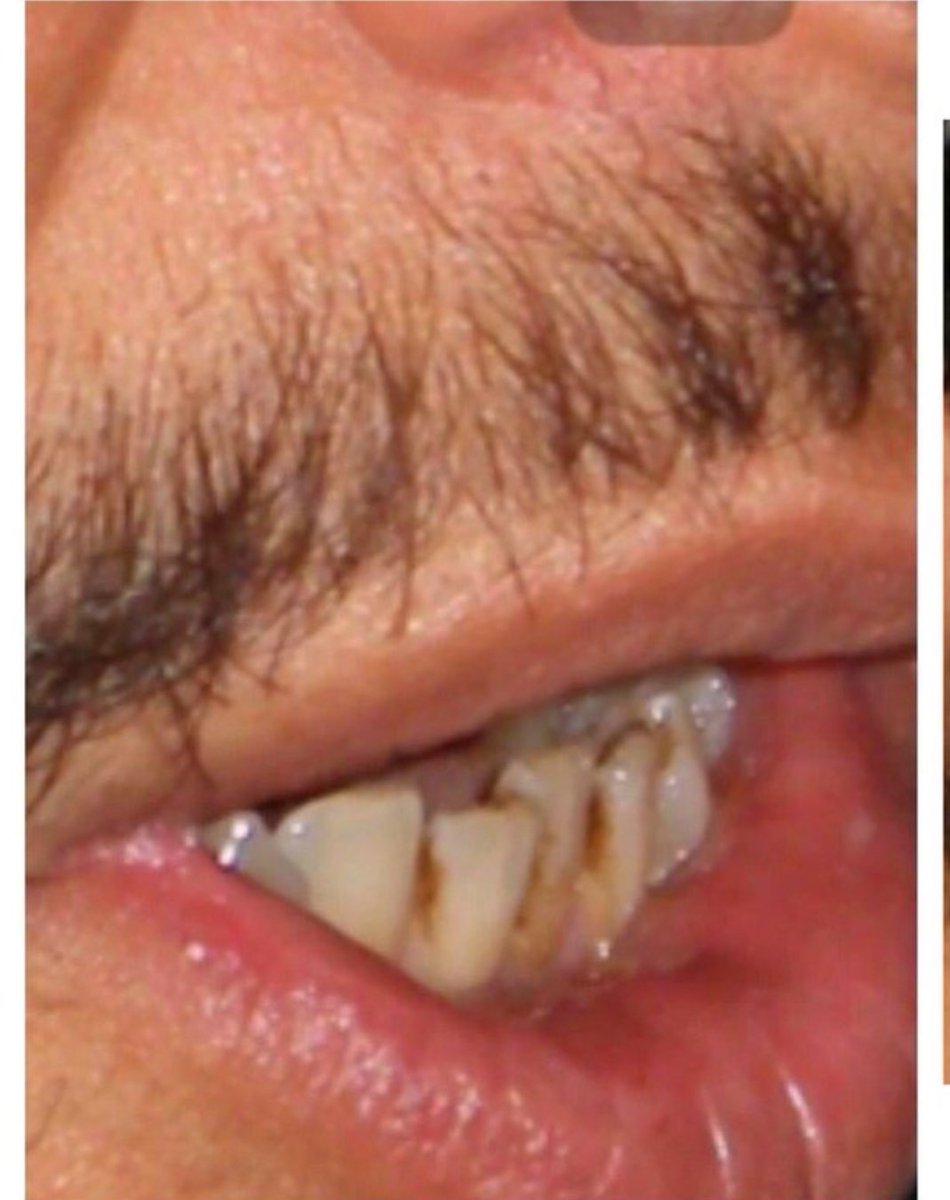 VickA. F. tweet media