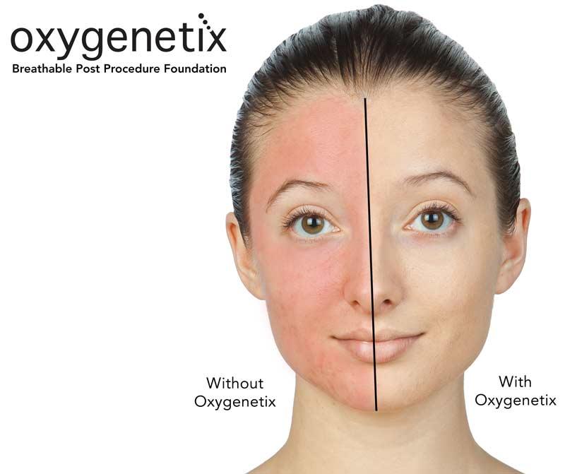 oxygenetix tweet media