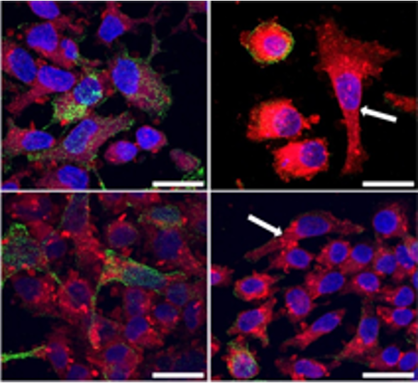 JHCnews's tweet image. New article in JHC: "Transforming Growth Factor-β Drives Epithelial Mesenchymal Transition and Reduces Synthesis of Unelaborated O-GalNAc Glycans in Breast Cancer Cells."   

Click to read for FREE: journals.sagepub.com/doi/full/10.13… 

#breastcancer #EMT #microscopy