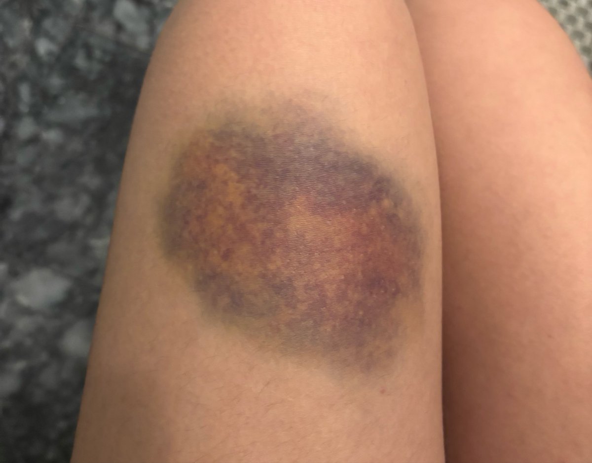 kitty⁷ 🪭 tweet media