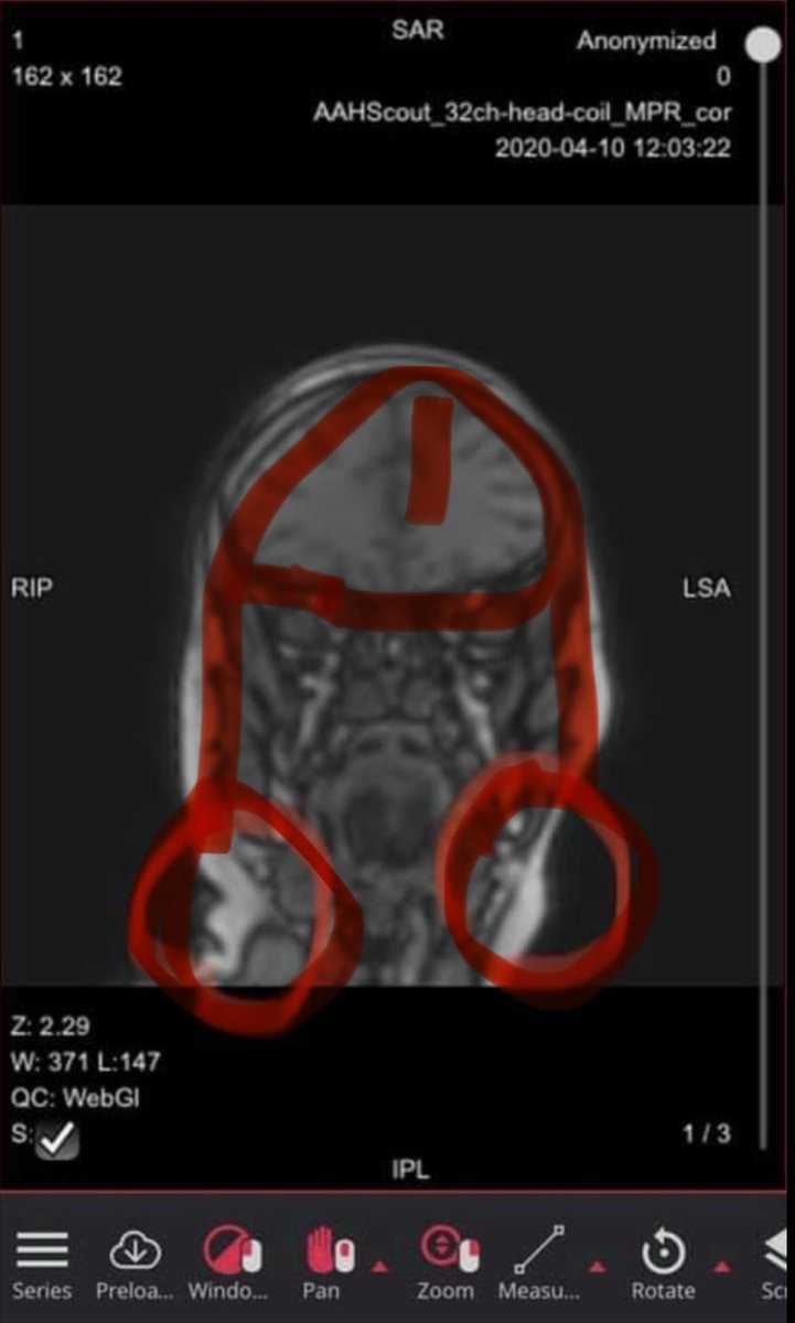 PhD in anal & rectal Cognition tweet media