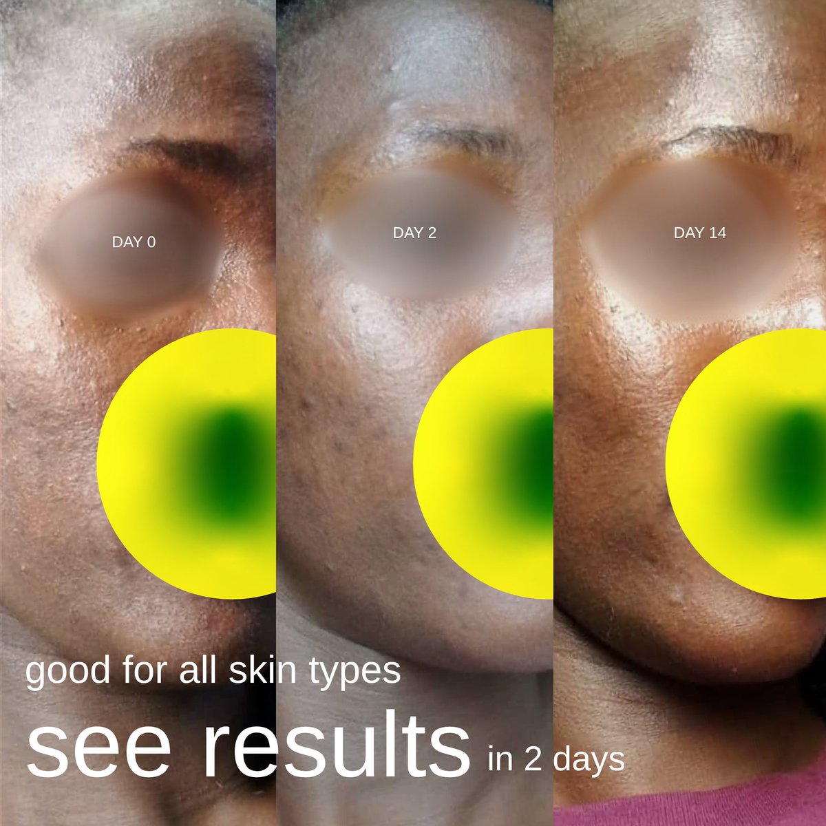 àdùfẹ́.🪲 tweet media