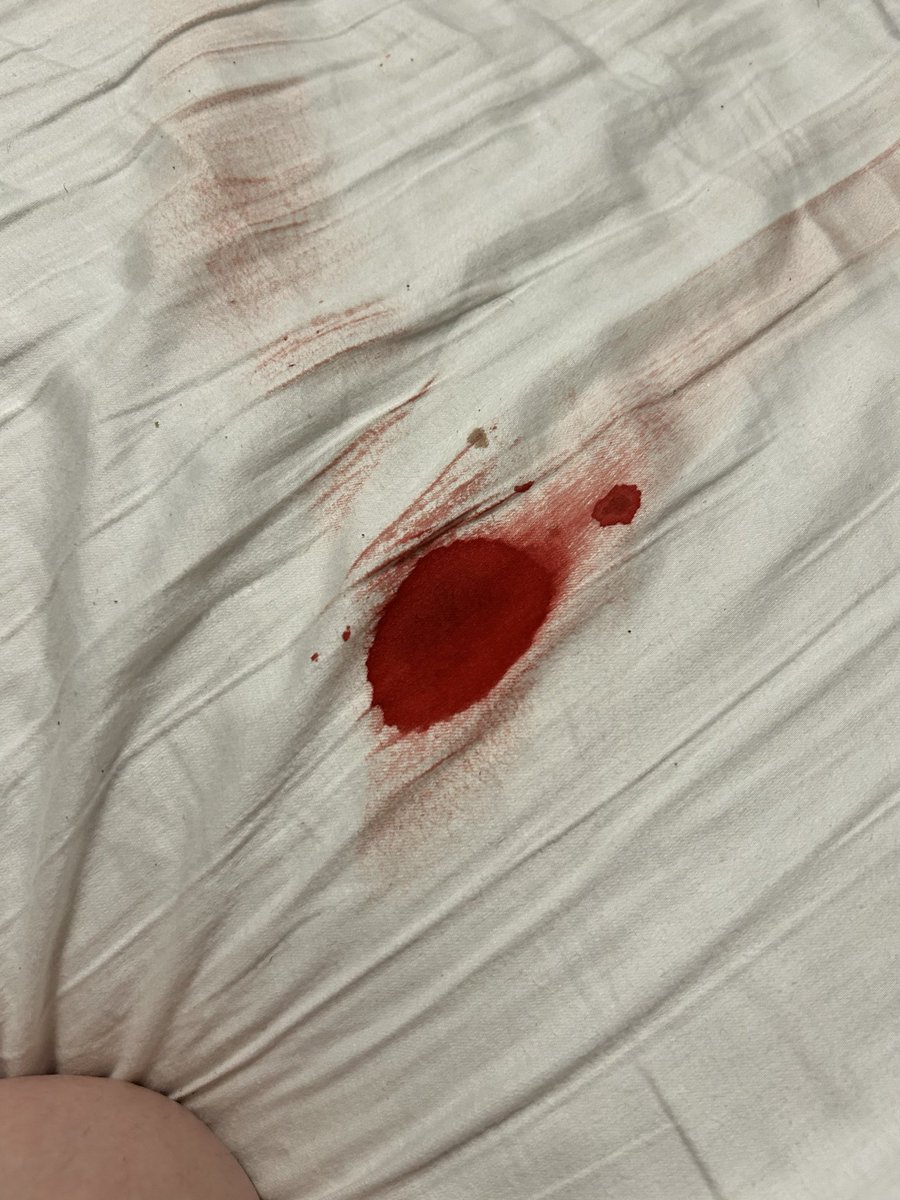 Ceratonine's tweet photo. A little blood never hurts anyone 
Period sex>>>>> https://t.co/O6xrGTn56h