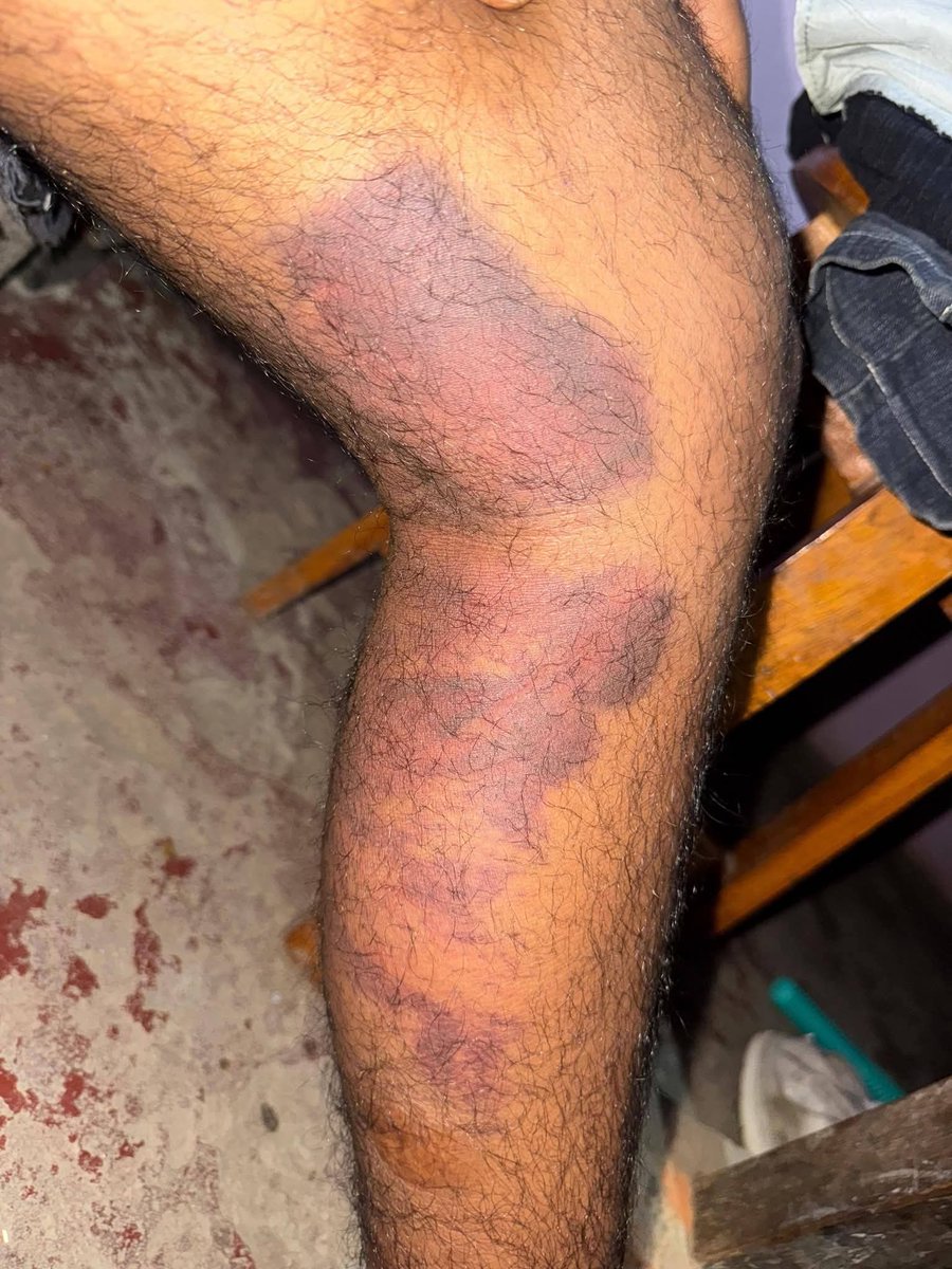 कुशीनगर कोतवाली पडरौना के सीधुआ चौकी पर तैनात दरोगा अखिलेश कुमार त्रिपाठी व दीवान द्वारा एक पक्ष से 50000 नहीं देने पर बेरहमी से चौकी के रूम में बंद कर कर खूब पीटा ने का आरोप
जांच कर कार्रवाई की जाए
<a href="/Uppolice/">UP POLICE</a>
<a href="/dgpup/">DGP UP</a> <a href="/AdgGkr/">ADG ZONE Gorakhpur</a> <a href="/diggorakhpur/">DIG Range Gorakhpur</a> <a href="/kushinagarpol/">Kushinagar Police</a> <a href="/bstvlive/">भारत समाचार | Bharat Samachar</a> <a href="/DmKushinagar/">DM KUSHINAGAR</a>