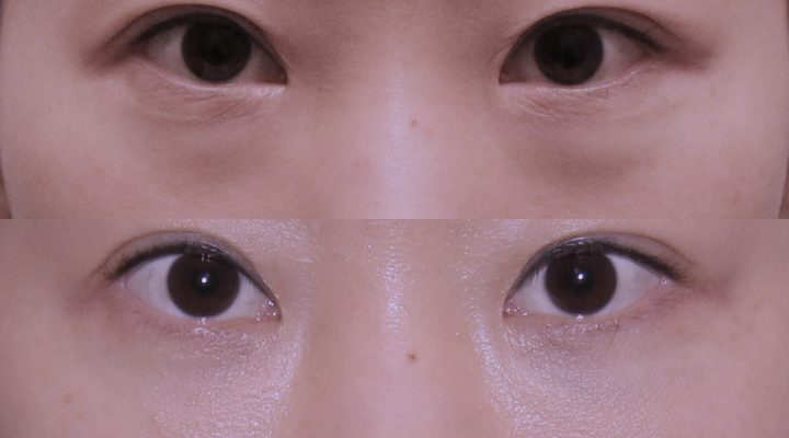 韓国ST美容整形外科 tweet media