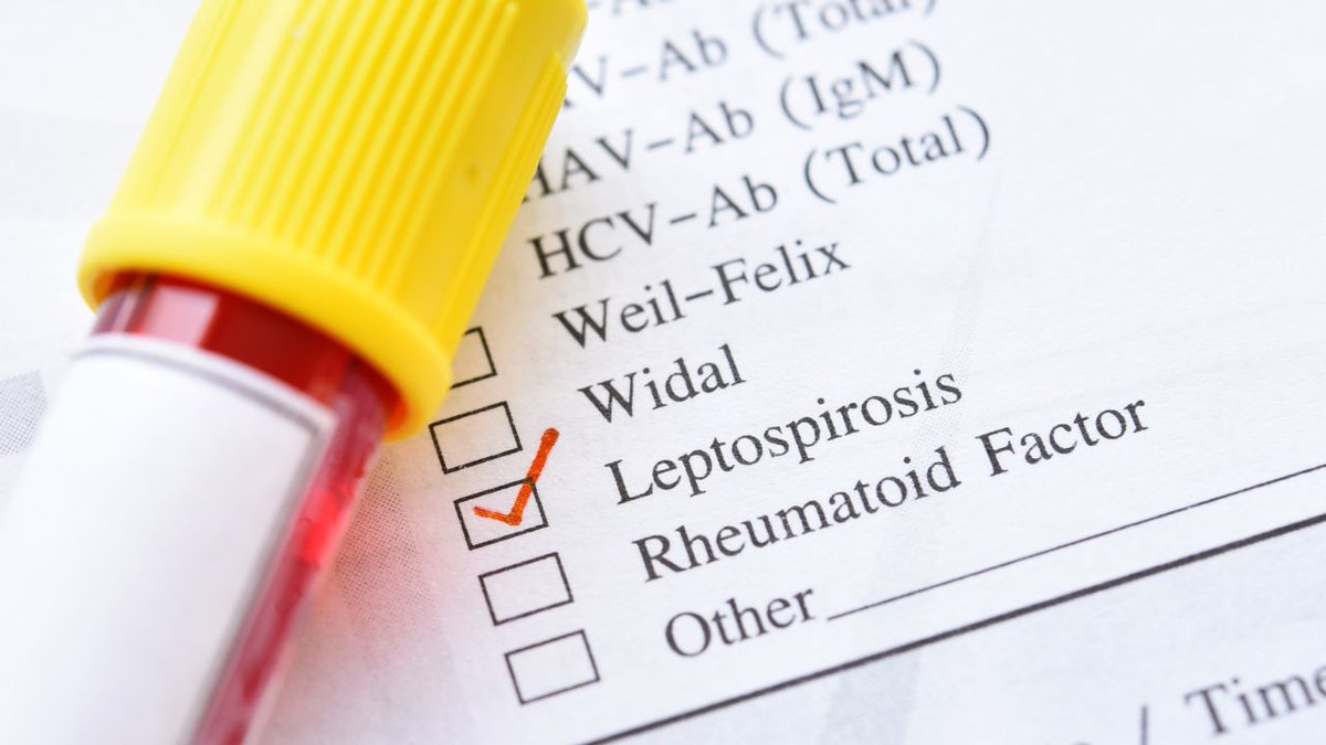 defimediainfo's tweet image. Leptospirose: un patient dans un état critique après une prise en charge tardive dlvr.it/TS8ttR #leptospirose #santé #urgence #maladie #hôpital