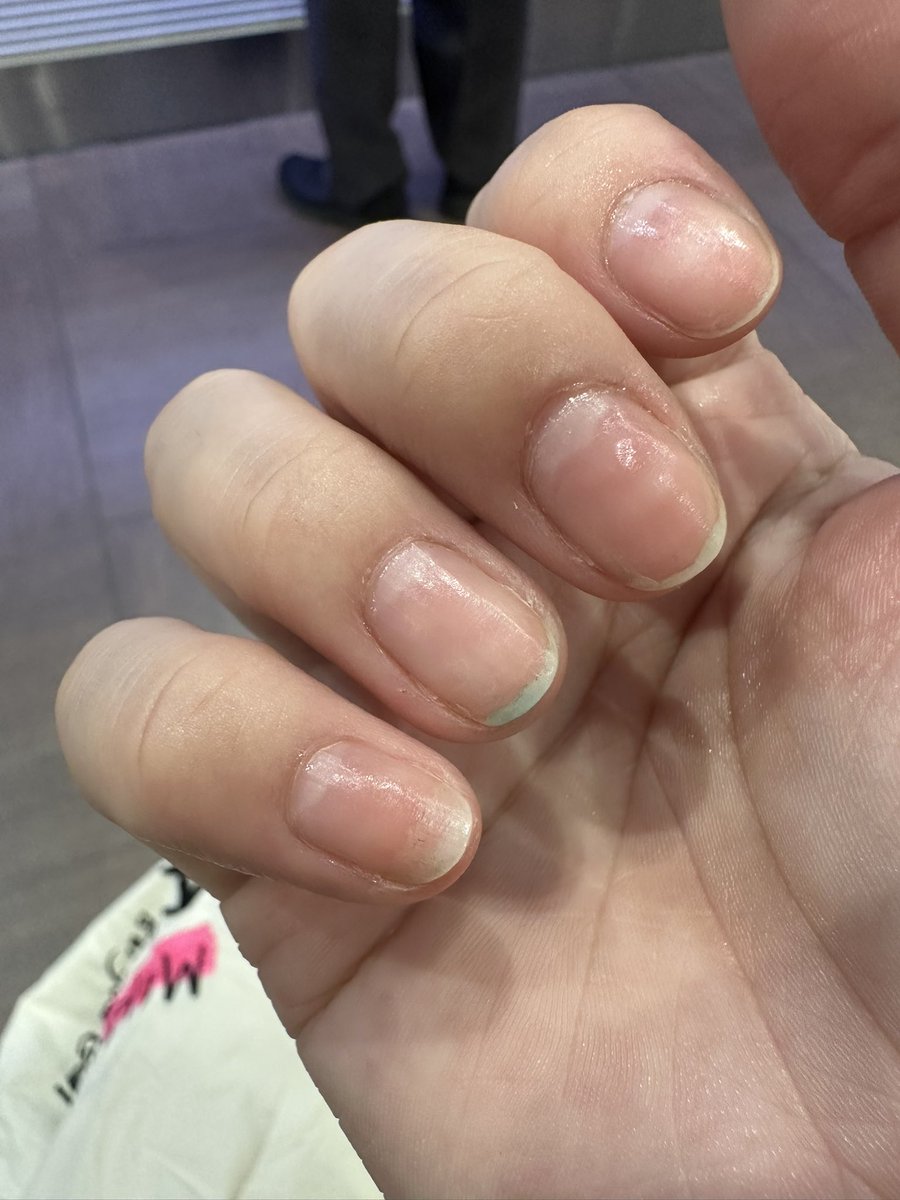 はむ☺︎ tweet media