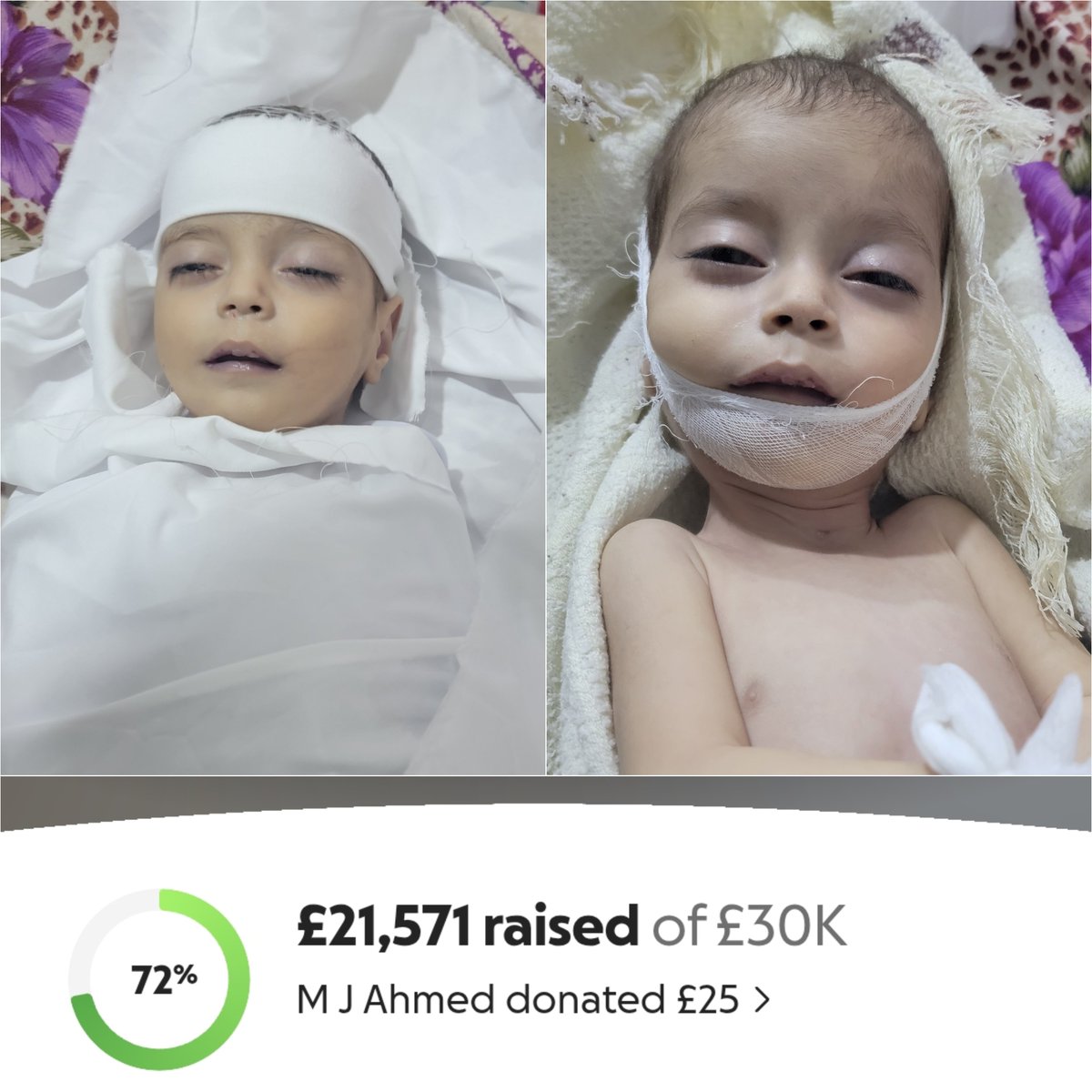 kimo_433's tweet photo. Mustafa has passed away… but your humanity is still alive 🤲💔
The donations that were for his treatment have now become a way to comfort his patient family. They are living under the pressure of poverty, and our goal is to build them a home that preserves their dignity.
“Allah is in the aid of the servant as long as the servant is in the aid of his brother.”
Be their support… donate and share 🙏
🔗 [https://t.co/PMVQcHT6kj]