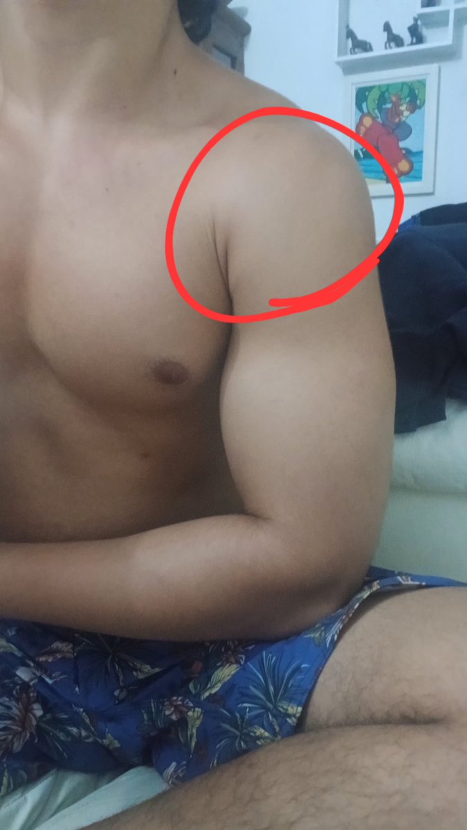 Huguinhosinho's tweet photo. Meus ombros estão mó paia ;-;
#ombros #calistenia #shape #brotheragem #novinho https://t.co/Ff9leuDlHz