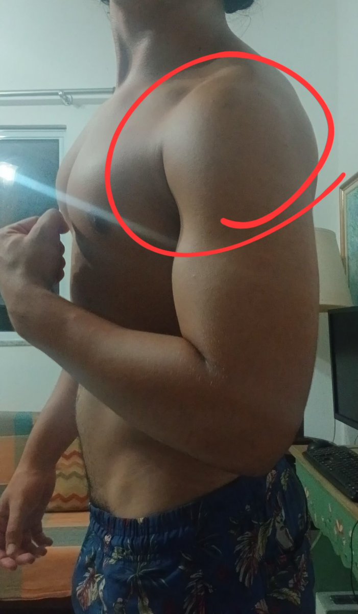 Huguinhosinho's tweet photo. Meus ombros estão mó paia ;-;
#ombros #calistenia #shape #brotheragem #novinho https://t.co/Ff9leuDlHz