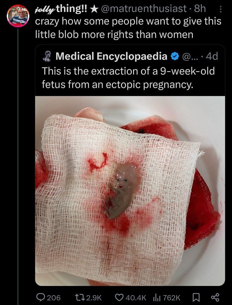 Insane Cope tweet media