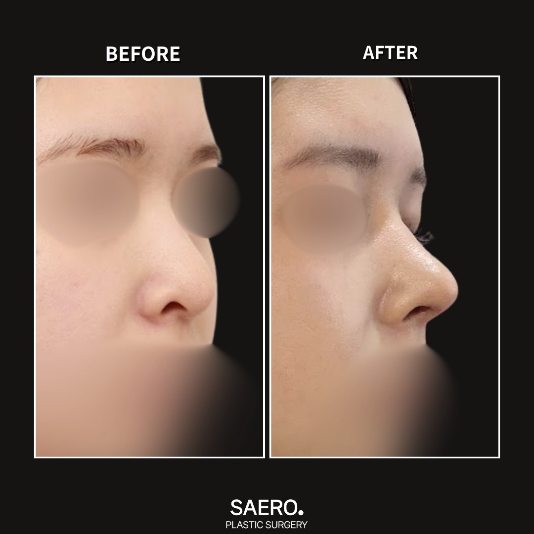 セロ美容外科 tweet media