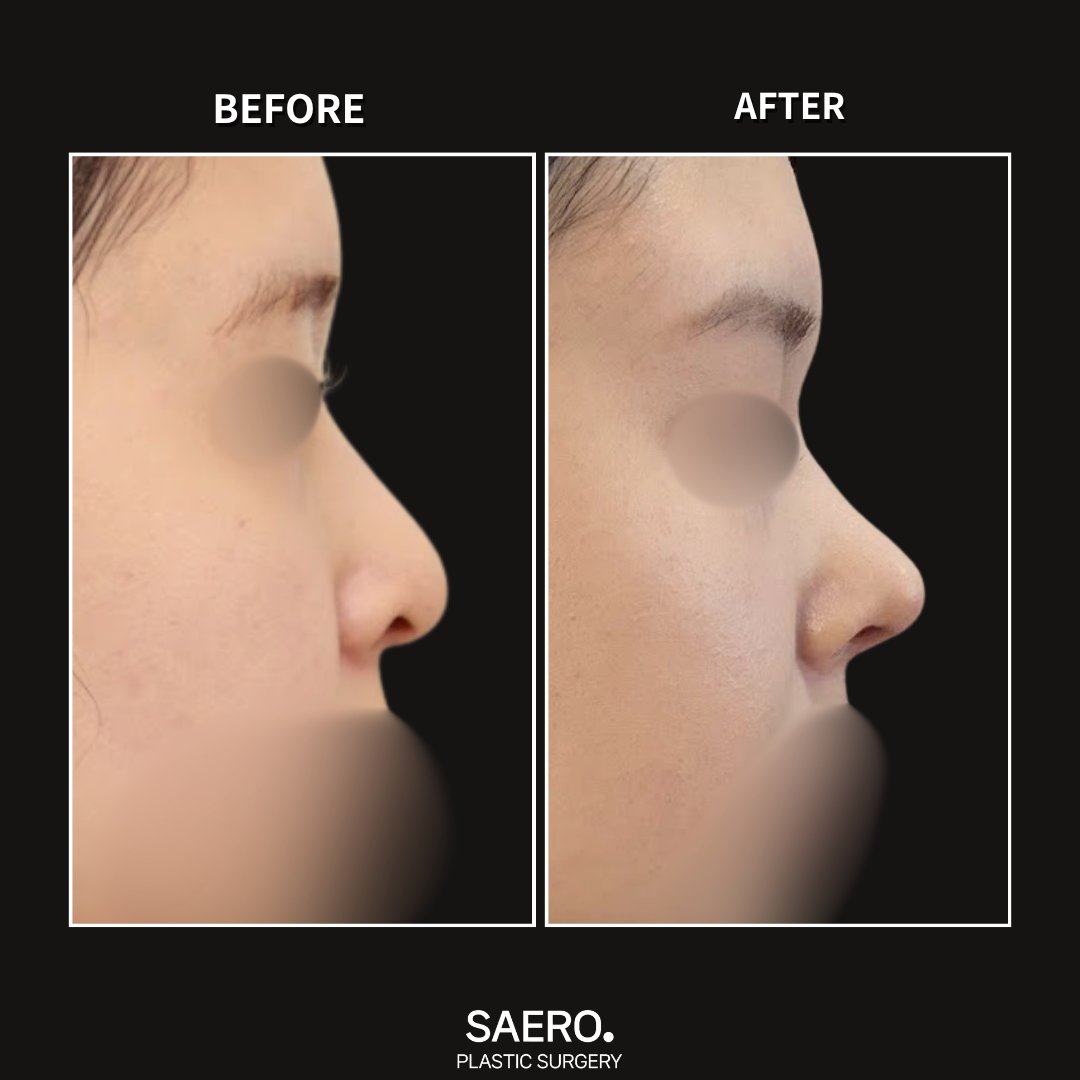 セロ美容外科 tweet media