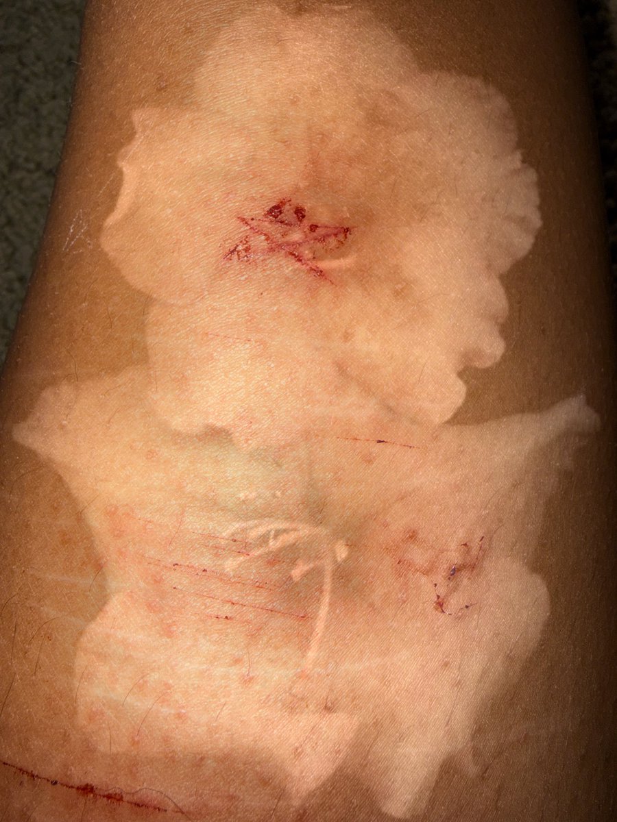 honestlyrosie's tweet photo. ‼️ ALL FAKE, SFX MAKEUP, FAKE BLOOD ‼️
sesh from today!
guys is this lowkey cutspo..
#shtwt #shedtwt #star #deepstyro #styrosesh https://t.co/dpEqLZCXqT