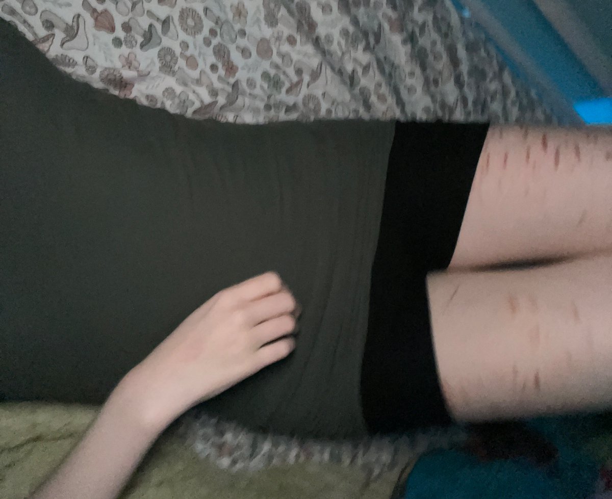 marz of shedtwt ALT tweet media