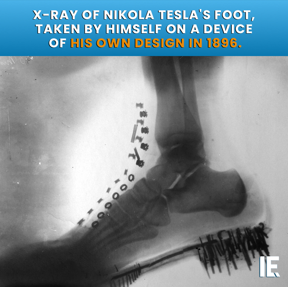 IntEngineering's tweet image. A shadowgraph of a human foot with a shoe on. Tesla made this image in 1896 with X-rays generated by his own vacuum tube, at a distance of 2.5 meters.⁠
⁠
#NikolaTesla #XRay #Shadowgraph #historyofscience