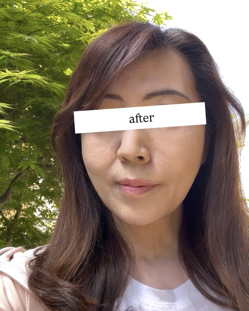 SEA CLINIC🌊小顔脂肪吸引ならシークリニック tweet media