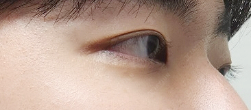 〚公式〛JAYJUN美容外科•皮膚科｜韓国美容 tweet media