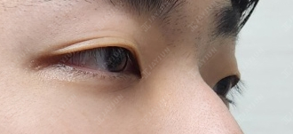 〚公式〛JAYJUN美容外科•皮膚科｜韓国美容 tweet media