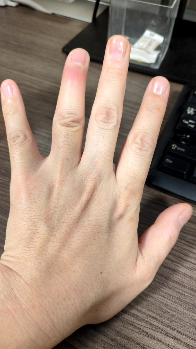 まるる tweet media