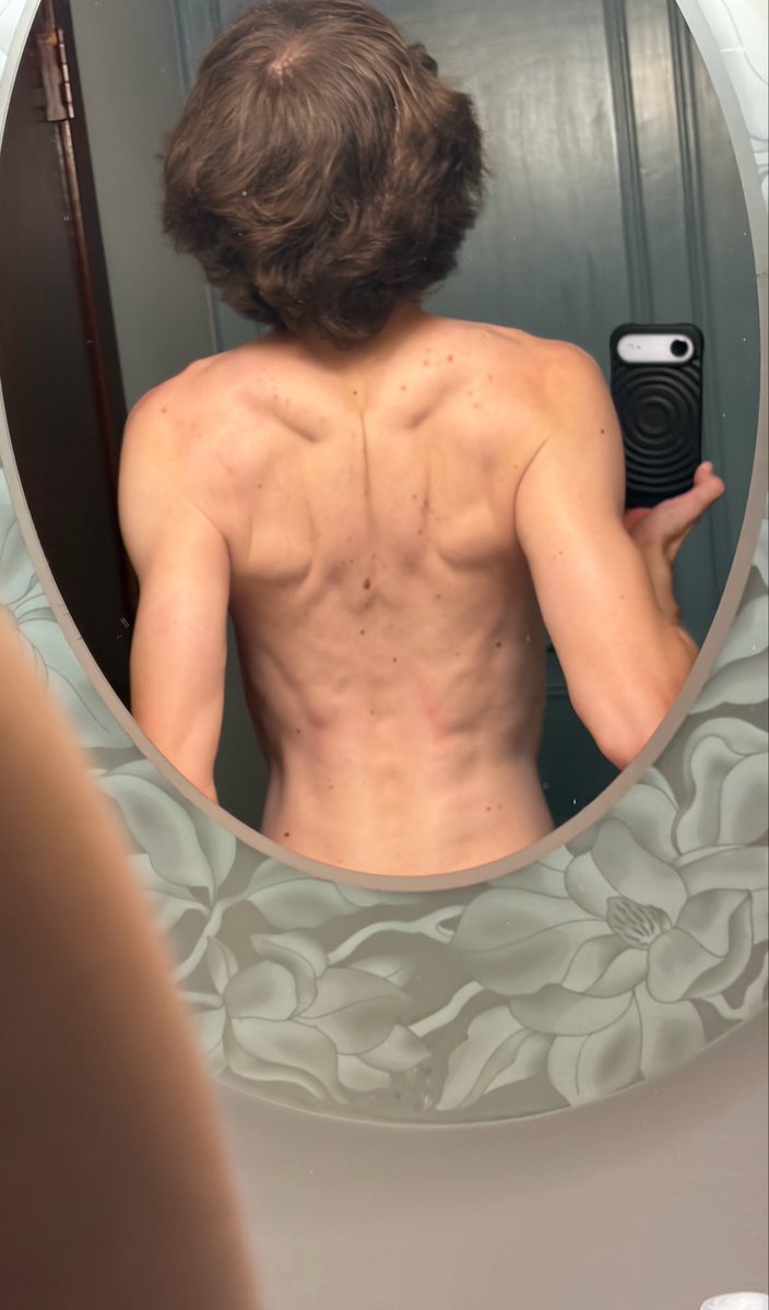 F1LTHYFLEET's tweet image. Chat make sure you workout tonight before you sleep. If I can do it so can you. Check out the back gains!  🤠🤞#Thegrinddontstop #FitnessForLife #Fit 
Motivation: @fousey @stevewilldoit @ShaneStoffer