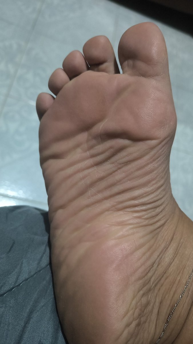 LittleFeet78's tweet photo. https://t.co/rIo3qeArnX https://t.co/ADHFzswpbl